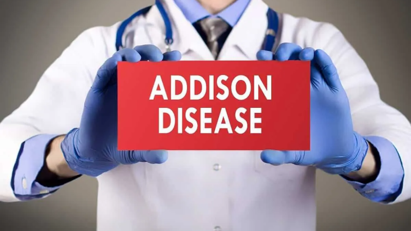 Addison Hastalığı Nedir? Belirtileri, Nedenleri ve Tedavisi